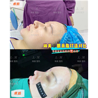 上海琳美鼻综合整形