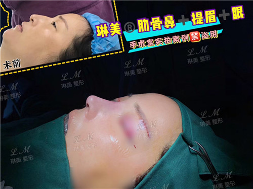 上海琳美鼻综合整形