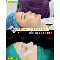 上海琳美鼻综合整形