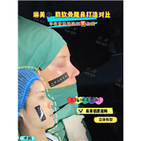 上海琳美鼻综合整形