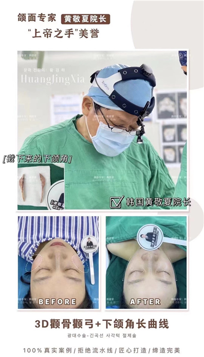 琳美磨骨整形