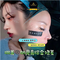 上海琳美鼻综合整形
