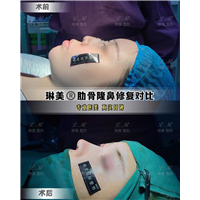 上海琳美鼻综合整形