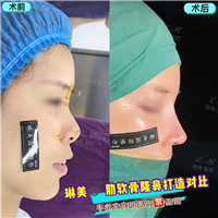 上海琳美鼻综合整形