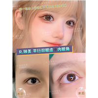 上海琳美眼综合整形