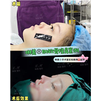 上海琳美鼻综合整形