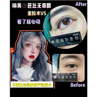 上海琳美眼综合整形