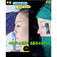 上海琳美鼻综合整形