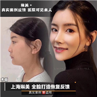 上海琳美全脸打造