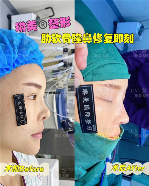 上海琳美鼻综合整形