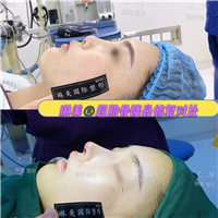 上海琳美鼻综合整形