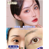 上海琳美眼综合整形