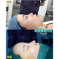 上海琳美鼻综合整形
