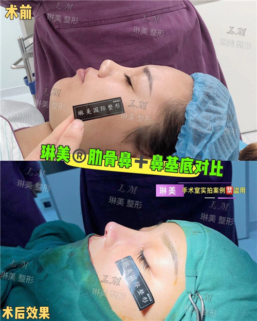 上海琳美鼻综合整形