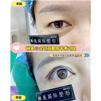 上海琳美眼综合整形