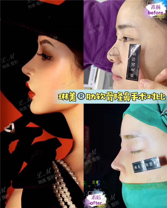 上海琳美鼻综合整形