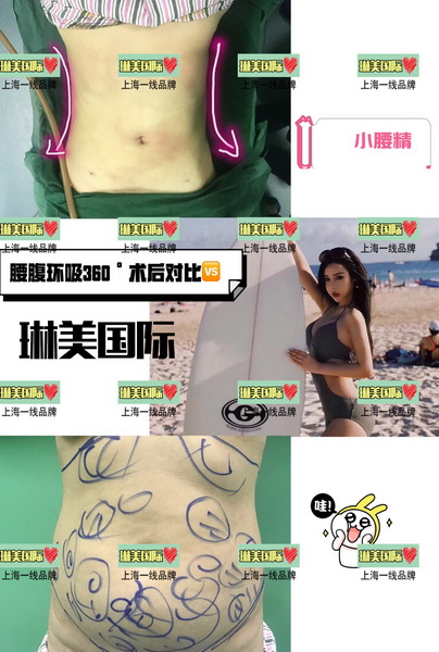 上海抖音**姐整形医院