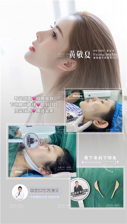 琳美磨骨整形