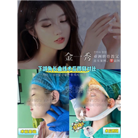 上海专业磨骨整形 