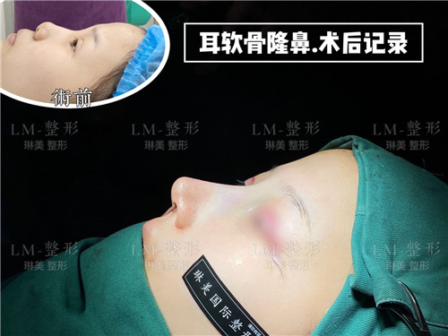 上海琳美鼻综合整形