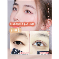 琳美整形眼综合整形 