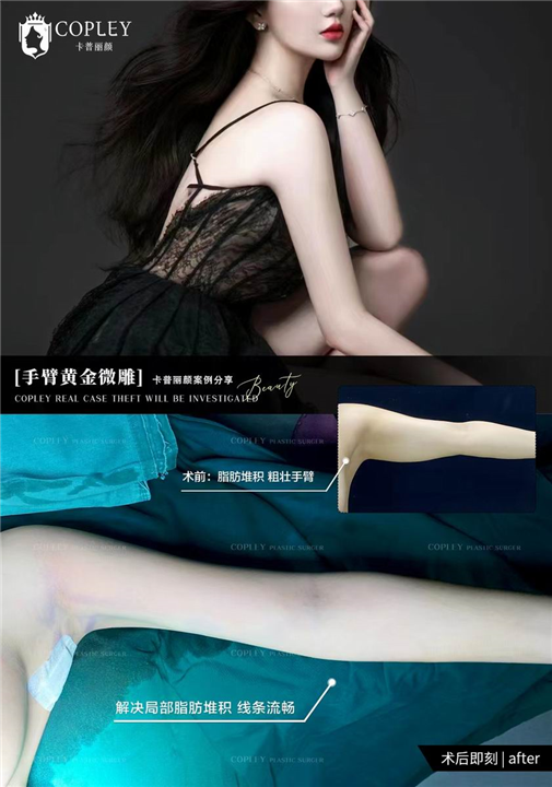 卡普丽颜