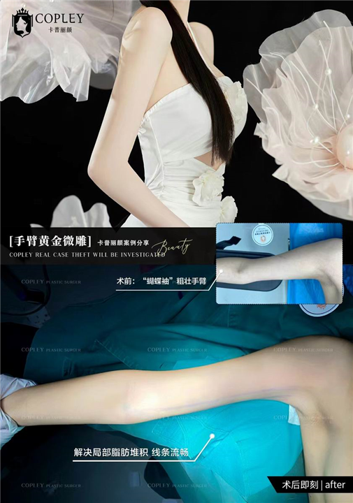 卡普丽颜