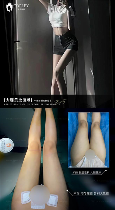 卡普丽颜