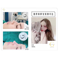 广州整形修复