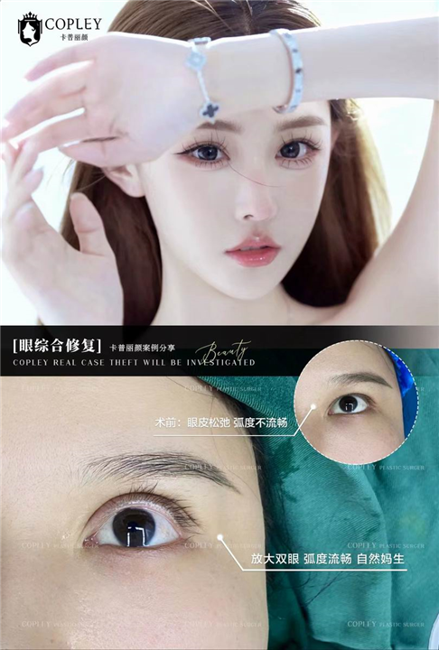 广州卡普丽颜整形