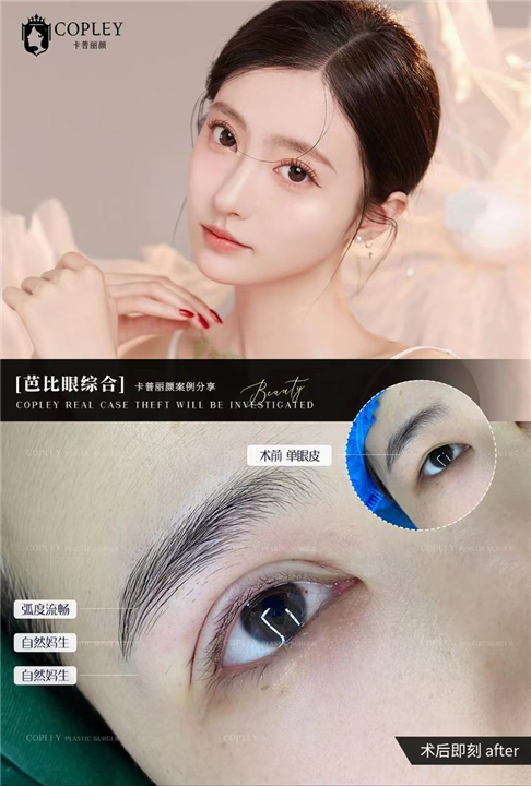 广州卡普丽颜整形