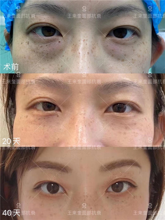 王来奎院长