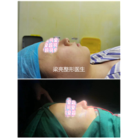 整形医生赵鹏