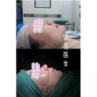 上海鼻整形修复专家