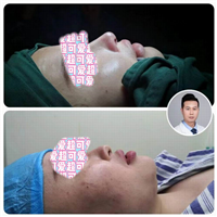 梁亮鼻整形医生