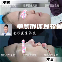 上海鼻部整形专家