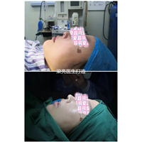 梁亮鼻整形医生
