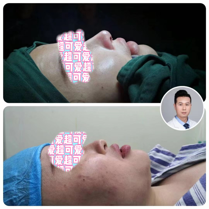上海梁亮医生技术好吗
