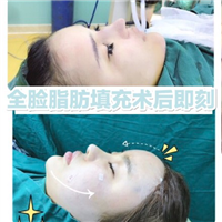 王武松|女神时代院长王武松