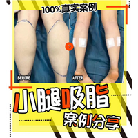 王武松整形医生|王武松医生