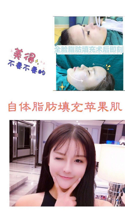 女神时代院长王武松|上海女神时代整形