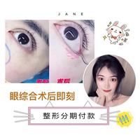 上海人气网红整形|上海专业鼻综合整形医生