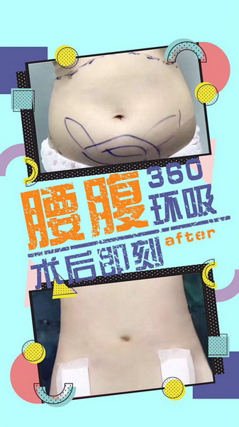 王武松整形医生|王武松医生