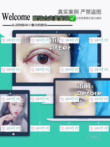 王武松|女神时代院长王武松