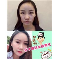 女神时代院长王武松|上海女神时代整形