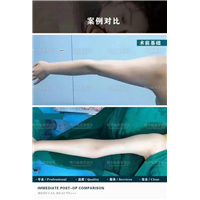 上海HZ整形