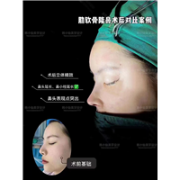 上海DRO整形