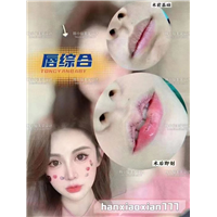 上海HZ整形