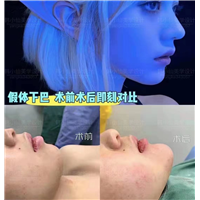 上海DRO整形