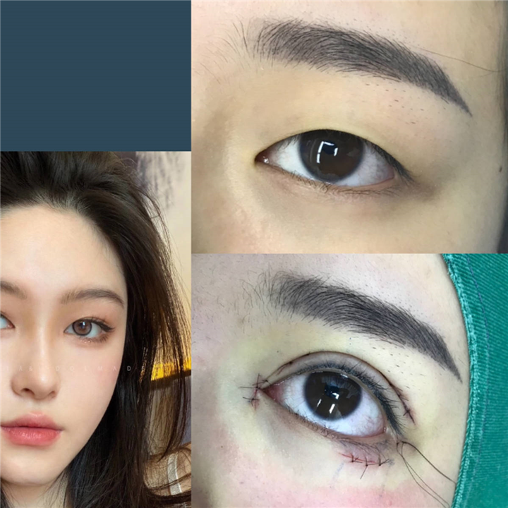 上海眼综合整形专家 
